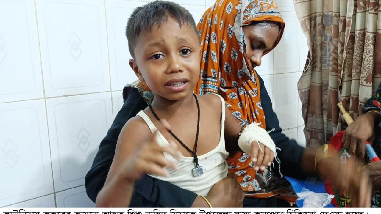 কাউনিয়ায় কুকুরের কামড়ে শিশুর হাতের বুড়ো আঙুল বিচ্ছিন্ন*